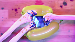 Rheumatoid Arthirtis